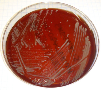 Mycobacterium smegmatis