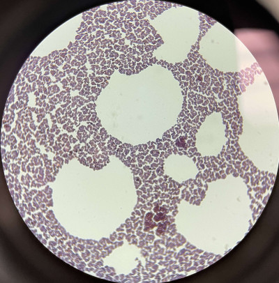 Gram Stain of Staphylococcus xylosus Under Brightfield Microscopy