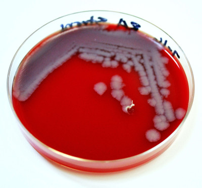 Bacillus anthracis Plate