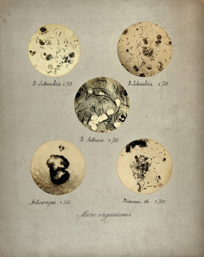 Tuberculosis and Anthrax bacilli