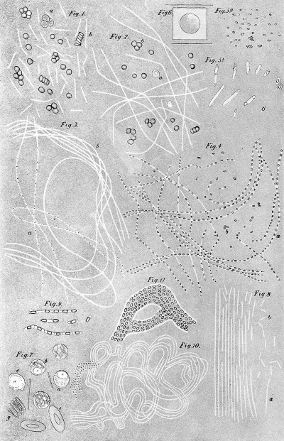 Aetiologie der Milzbrandkrankheit. Wellcome L0000893