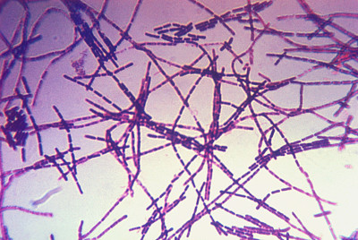 Bacillus anthracis Gram