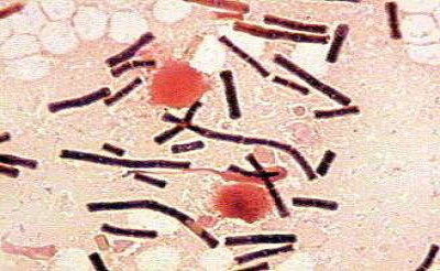 Bacillus anthracis