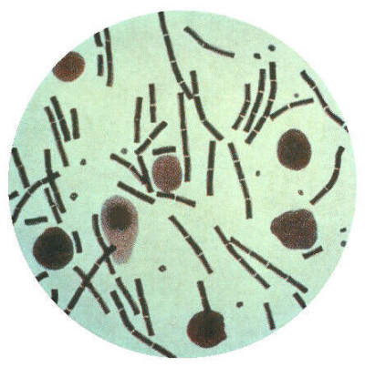 Bacillus anthracis