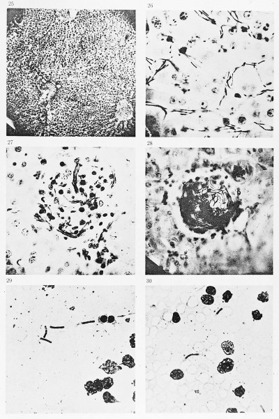 Anthrax bacillus