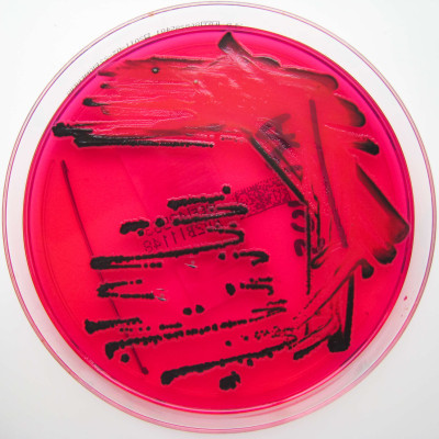 Salmonella species growing on XLD agar - Showing H2S production