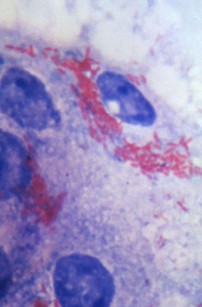 Rickettsia prowazekii in Yolk Sac Smear Stained by Macchiavello Technique