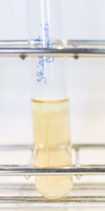 Shigella sonnei in SIM Agar 126