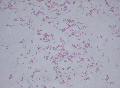 Klebsiella oxytoca