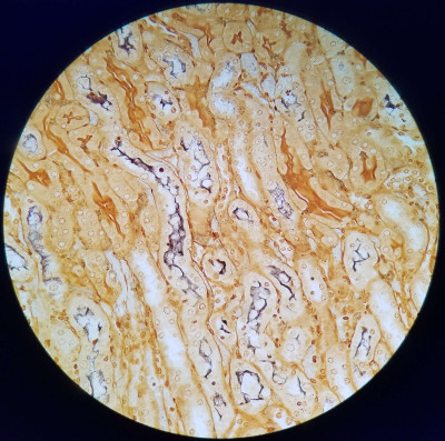 Leptospira in kidney