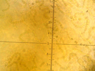 Nostoc flagelliforme under Microscope