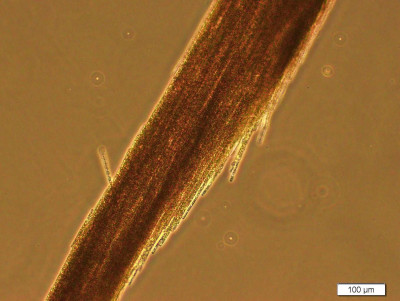 Aphanizomenon Colony Fluorescence Microscopy