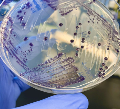 Violacein-Producing Massilia Growing on a Petri Plate