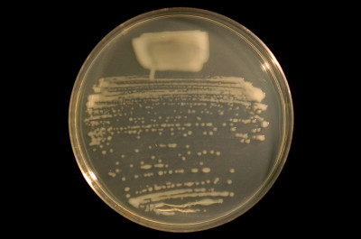 Mesorhizobium loti Strain on Tryptone-Yeast Extract Agar