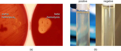 Comparative Hemolytic Activity of Streptococcus Species on Blood Agar Plates