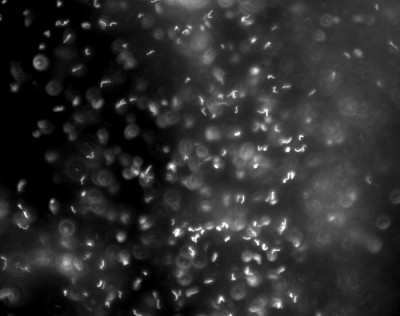 Spirillum Bacteria (6269249676)