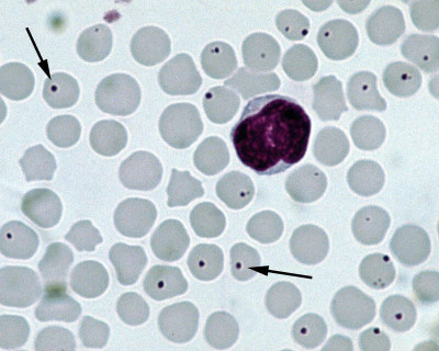 Anaplasma-centrale-cattle-blood-Giemsa-stain