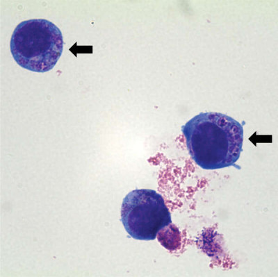 Anaplasma phagocytophilum cultured in human promyelocytic cell line HL-60