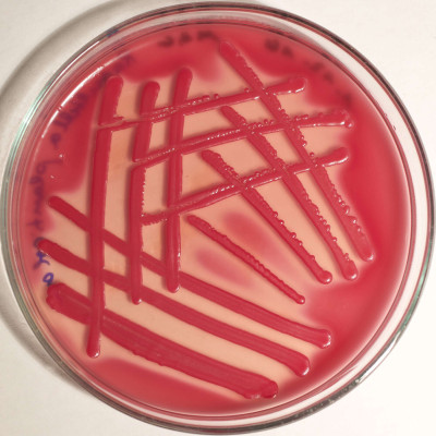 Raoultella planticola MacConkey Colonies 32