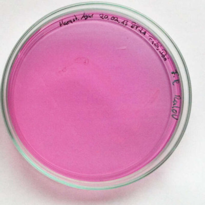 Raoultella planticola on urea agar