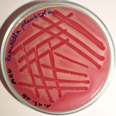 Raoultella planticola MacConkey Colonies 33