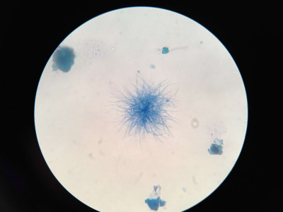 Saccharopolyspora erythraea