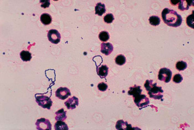 Streptococcus viridans