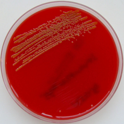 Sphingomonas paucimobilis on Columbia Horse Blood Agar