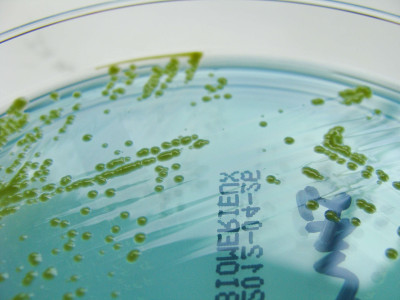 Sphingomonas paucimobilis on CLED Agar