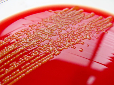 Sphingomonas paucimobilis on Columbia Horse Blood Agar - Detail