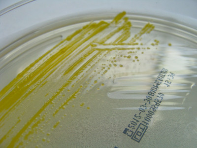 Sphingomonas paucimobilis on Nutrient Agar - Detail