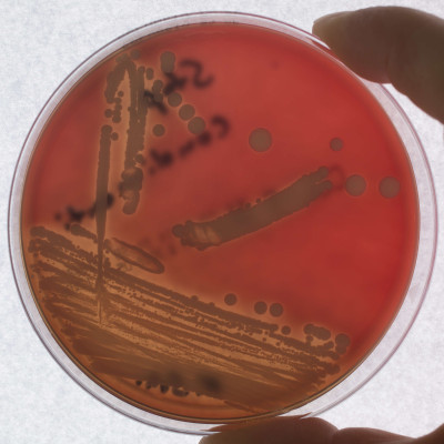 Staphylococcus condimenti Columbia-Blutagar Haemolyse 085