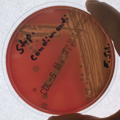 Staphylococcus condimenti Columbia-Blutagar Haemolyse 086