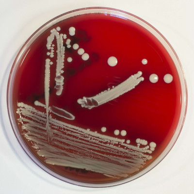 Staphylococcus condimenti Columbia-Blutagar 072