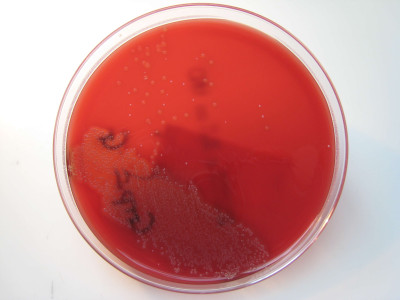 Streptococcus dysgalactiae on Columbia Horse Blood Agar