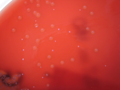 Streptococcus dysgalactiae on Columbia Horse Blood Agar