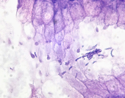 Helicobacter heilmannii in Gastric Mucosa