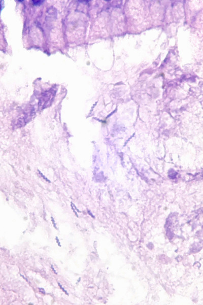 Helicobacter heilmannii in Gastric Mucosa