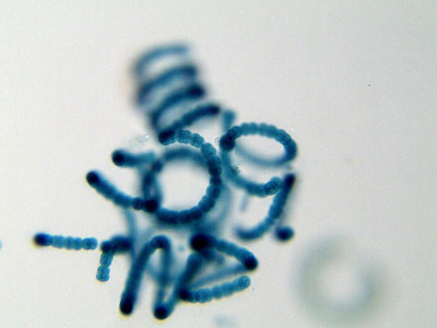 Anabaena