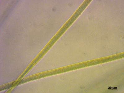 Nodularia Spumigena SNAP-202230-0011