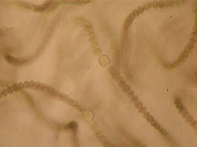 Trichomes and Heterocysts