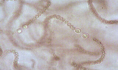 Trichomes Showing Heterocysts