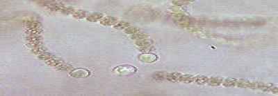 Trichomes and Heterocysts