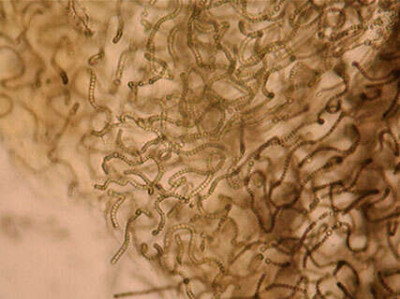 Trichomes in Gelatinous Matrix