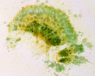 Highly Enlarged Cross-Section of a Colony Under Transmitted Light