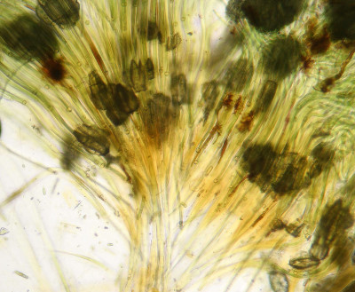 Trichomes - Lower Portions - Microscope Low Magnification