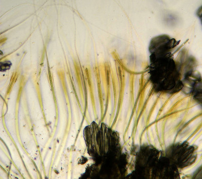 Trichomes - Sheaths - Microscope Low Magnification