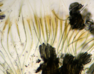 Trichomes - Sheaths - Microscope Low Magnification