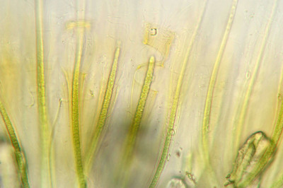 Trichomes - Sheath Tips - Magnified