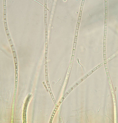 Trichomes - Hyaline Tips - Magnified